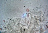 Echinoderma asperum image