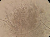 Hypomyces aurantius image