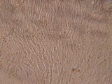 Crocicreas cyathoideum image