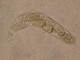 Hysterographium fraxini image