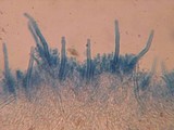 Hyphodontia subalutacea image