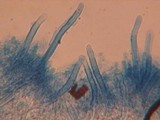Hyphodontia subalutacea image