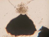 Leptosphaeria purpurea image