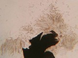Leptosphaeria purpurea image
