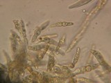 Leptosphaeria purpurea image