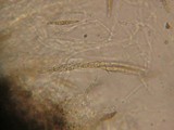 Leptosphaeria purpurea image