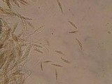 Leptosphaeria purpurea image