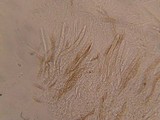 Leptosphaeria purpurea image