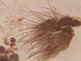 Dematioscypha dematiicola image