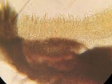 Dematioscypha dematiicola image