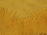 Dematioscypha dematiicola image
