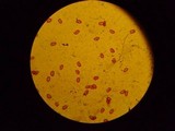 Hygrocybe nitida image