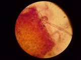 Ophiocordyceps sphecocephala image