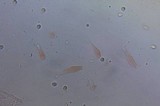 Amanita laurae image