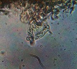Eocronartium muscicola image