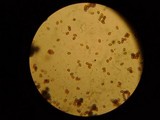 Agaricus placomyces image