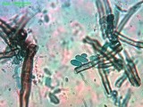 Veronaea botryosa image
