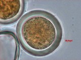 Sphaerosporium lignatile image
