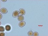 Sphaerosporium lignatile image
