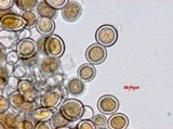 Sphaerosporium lignatile image
