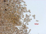 Sphaerosporium lignatile image
