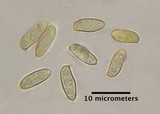 Caloboletus firmus image