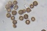 Scleroderma verrucosum image