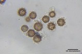 Scleroderma verrucosum image