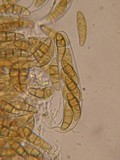 Leptosphaeria eustoma image