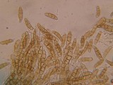 Leptosphaeria eustoma image