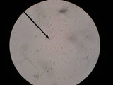 Lepiota clypeolaria image