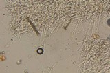 Ophiocordyceps melolonthae image