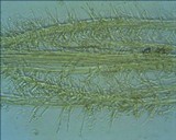 Tilachlidium brachiatum image