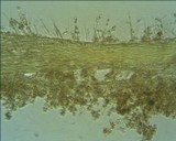 Tilachlidium brachiatum image