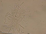 Orbilia sarraziniana image
