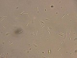 Orbilia sarraziniana image