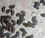 Leprieuria bacillum image