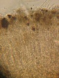 Patellariopsis clavispora image