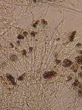 Patellariopsis clavispora image