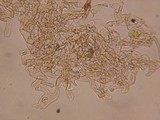 Coprinopsis phaeospora image