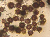 Scleroderma areolatum image