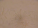 Orbilia delicatula image