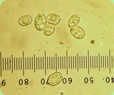 Pluteus petasatus image