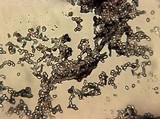 Punctularia atropurpurascens image