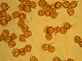 Nolanea pseudostrictia image