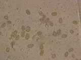 Inocybe phaeodisca image