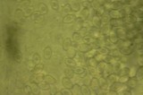 Leucocoprinus brebissonii image