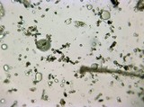 Punctularia atropurpurascens image