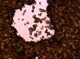 Reticularia lycoperdon image