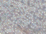 Trichoderma viride image